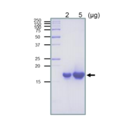 SDS-PAGE analysis of the purified RuvC protein.