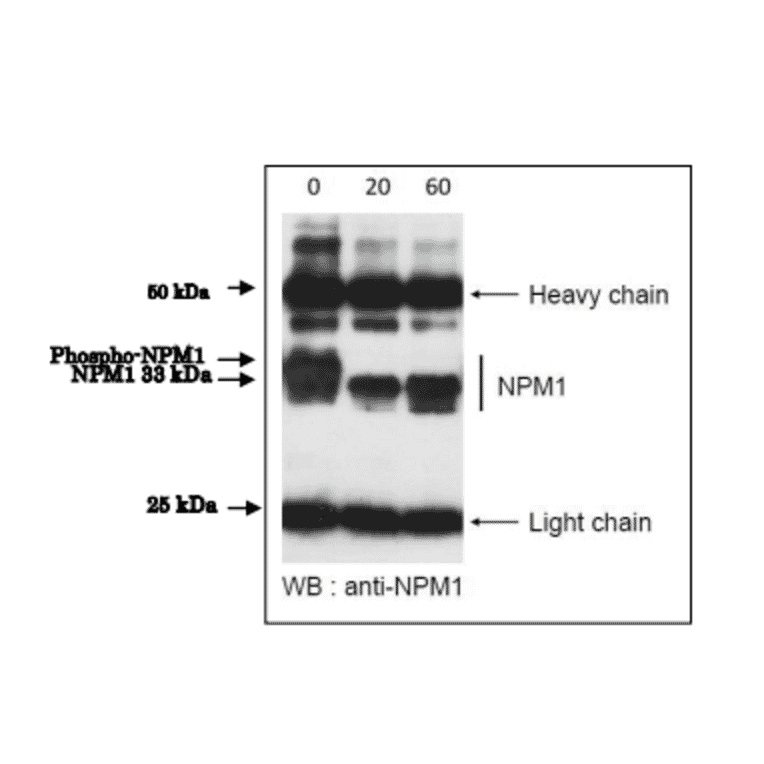 Dephosphorylation of phospho-NPM1 protein by incubation with ?protein phosphatase in vitro.