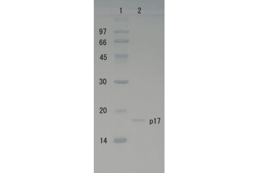 Polyacrylamide gel electrophoresis of HIV-1 p17 protein.
