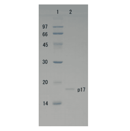 Polyacrylamide gel electrophoresis of HIV-1 p17 protein.