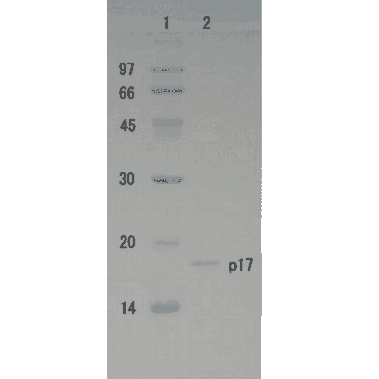 Polyacrylamide gel electrophoresis of HIV-1 p17 protein.