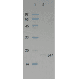 Polyacrylamide gel electrophoresis of HIV-1 p17 protein.