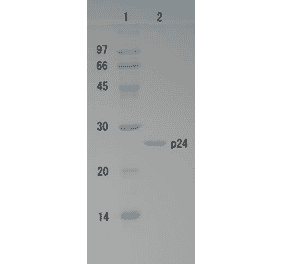 Polyacrylamide gel electrophoresis of HIV-1 p24 protein.