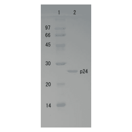 Polyacrylamide gel electrophoresis of HIV-1 p24 protein.