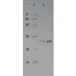 Polyacrylamide gel electrophoresis of HIV-1 p24 protein.