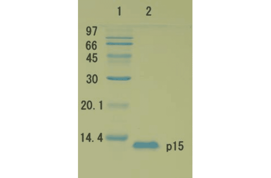 Polyacrylamide gel electrophoresis of HIV-1 p15 protein.