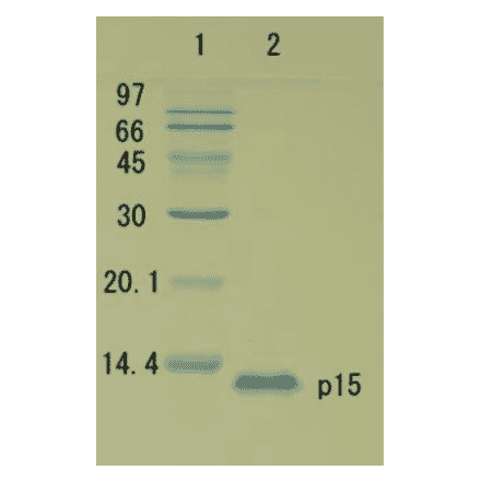 Polyacrylamide gel electrophoresis of HIV-1 p15 protein.