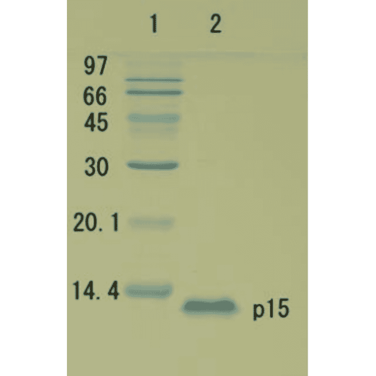 Polyacrylamide gel electrophoresis of HIV-1 p15 protein.