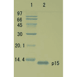 Polyacrylamide gel electrophoresis of HIV-1 p15 protein.