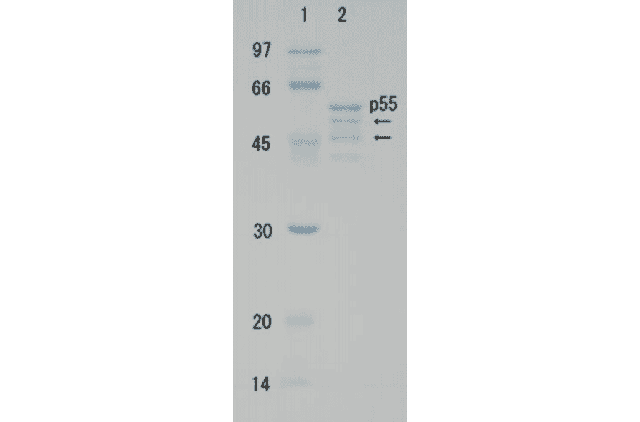 Polyacrylamide gel electrophoresis of HIV-1 p55 protein. The arrows show degradation products.