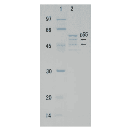 Polyacrylamide gel electrophoresis of HIV-1 p55 protein. The arrows show degradation products.