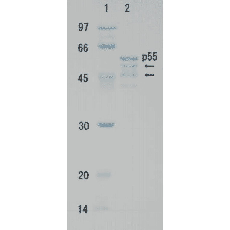 Polyacrylamide gel electrophoresis of HIV-1 p55 protein