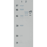 Polyacrylamide gel electrophoresis of HIV-1 p55 protein
