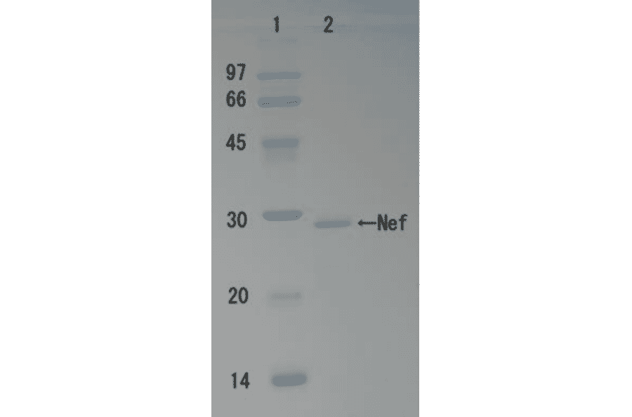 SDS-polyacrylamide gel electrophoresis of HIV-1 Nef protein.