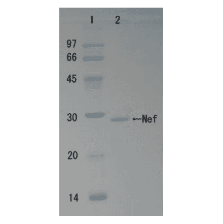 SDS-polyacrylamide gel electrophoresis of HIV-1 Nef protein.