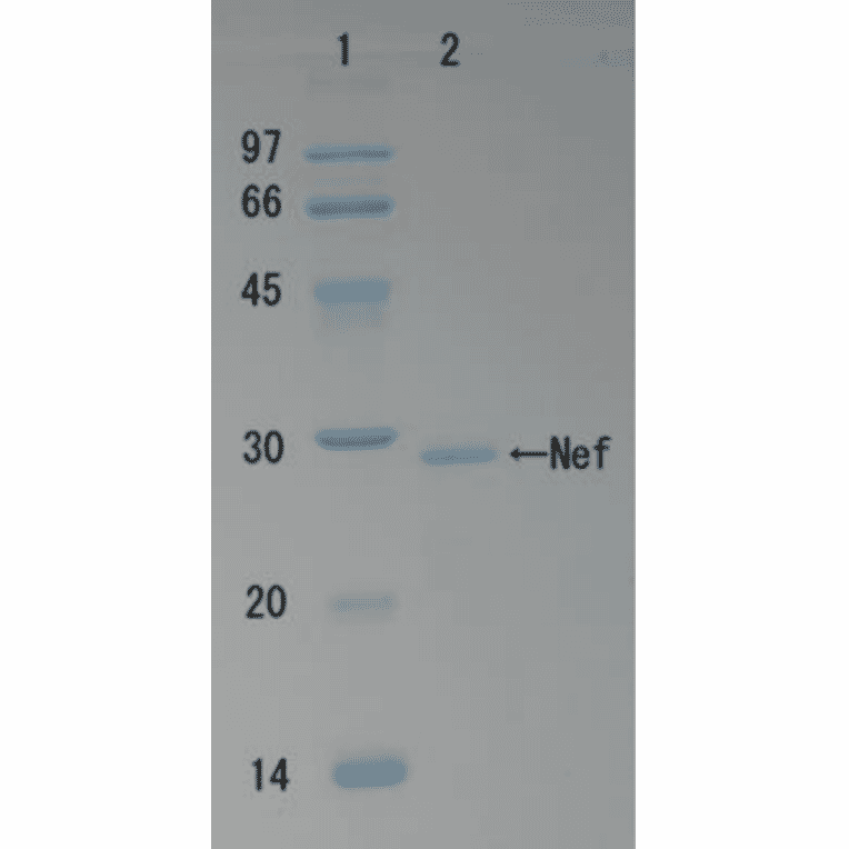 SDS-polyacrylamide gel electrophoresis of HIV-1 Nef protein.