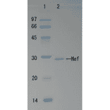 SDS-polyacrylamide gel electrophoresis of HIV-1 Nef protein.