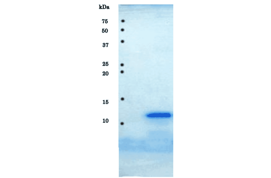 SDS-PAGE analysis of purified HIV-1 protease.