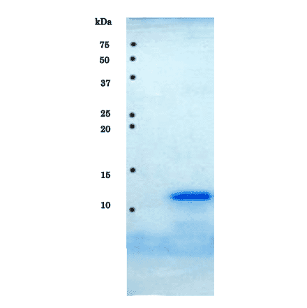 SDS-PAGE analysis of purified HIV-1 protease.