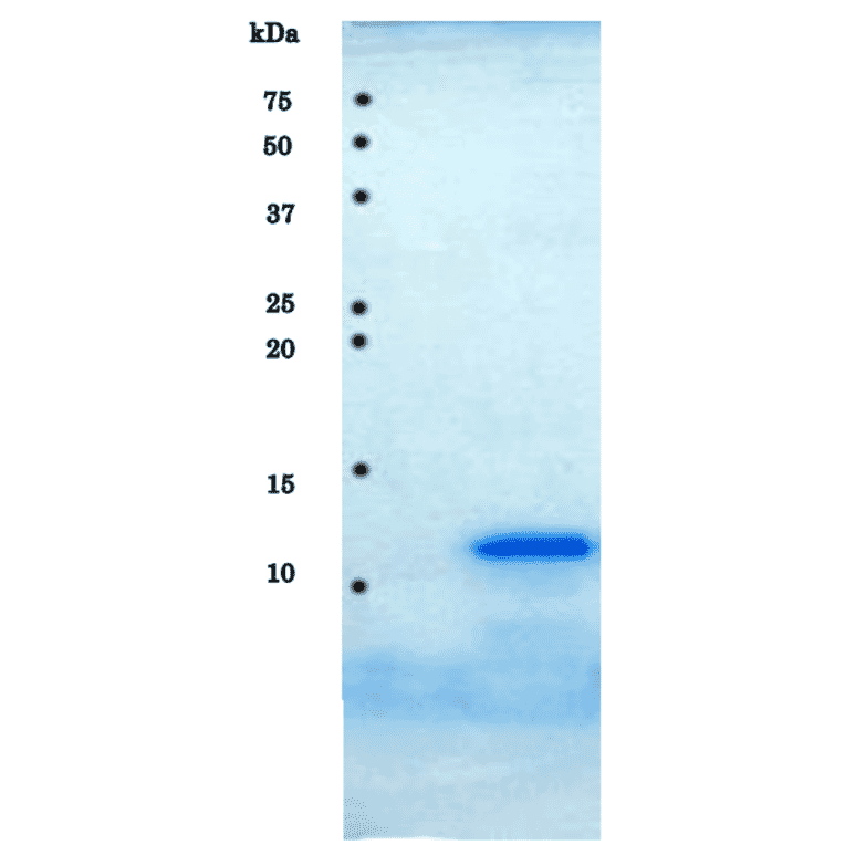 SDS-PAGE analysis of purified HIV-1 protease.