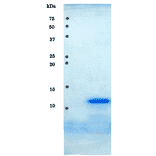 SDS-PAGE analysis of purified HIV-1 protease.