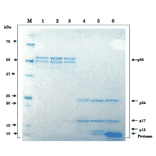 Proteolytic processing of HIV-1 Gag p55 proprotein by HIV-1 protease in vitro.