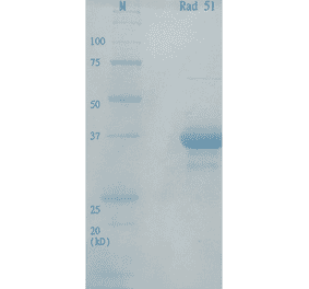 Analysis of purified human Rad51 protein by SDS-PAGE.