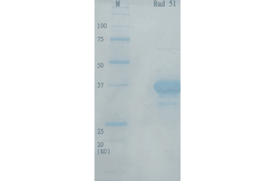 Analysis of purified human Rad51 protein by SDS-PAGE.