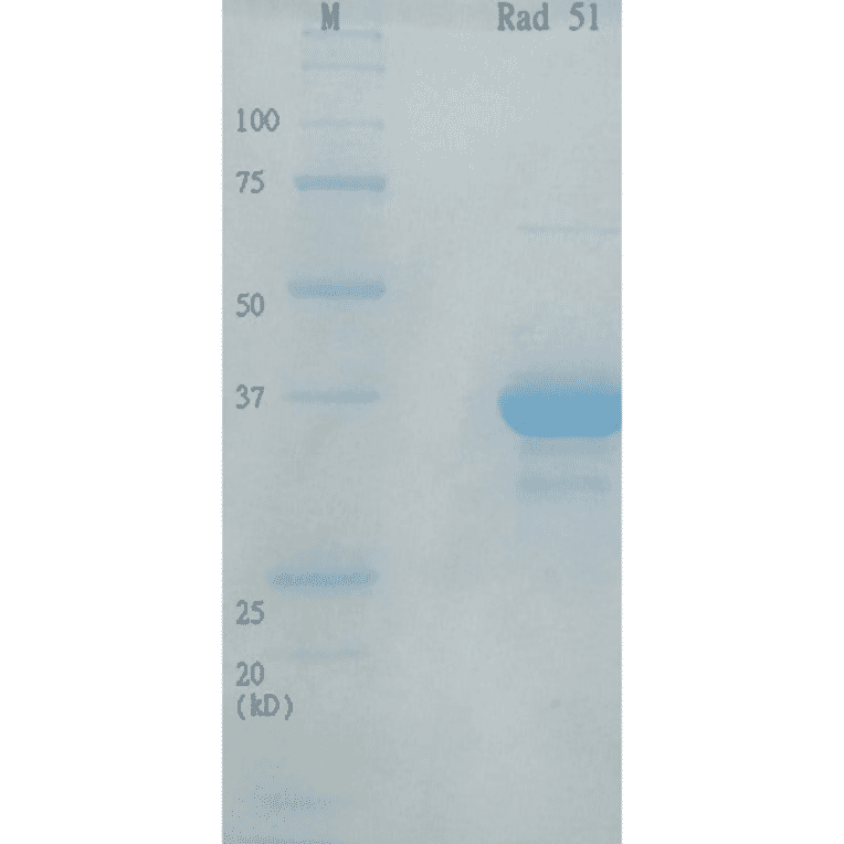 Analysis of purified human Rad51 protein by SDS-PAGE.