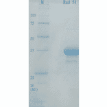 Analysis of purified human Rad51 protein by SDS-PAGE.