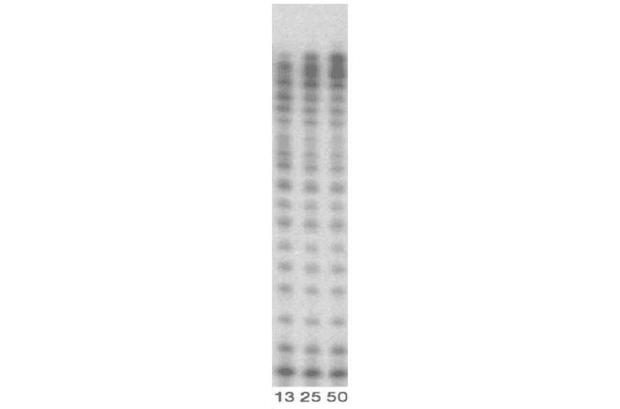 DNA polymerizing activity of Pol kappa (1-560 aa).