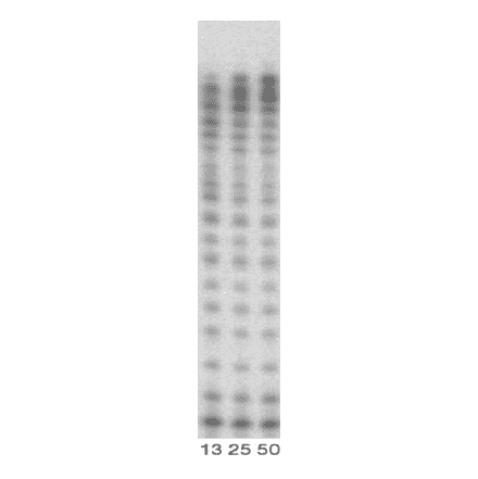 DNA polymerizing activity of Pol kappa (1-560 aa).