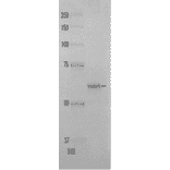Polyacrylamide gel electrophoresis of DNA polymerase kappa protein.