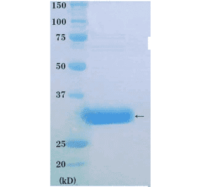 SDS-PAGE anlysis of purified PCNA protein.