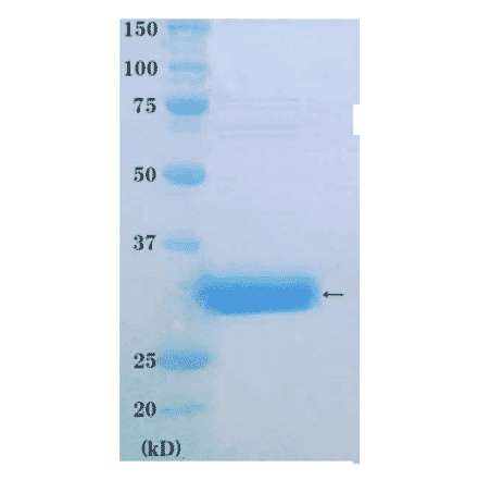 SDS-PAGE anlysis of purified PCNA protein.