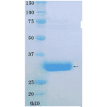 SDS-PAGE anlysis of purified PCNA protein.