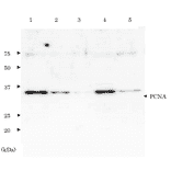 Western Bloting of PCNA. Lane 1; Purified PCNA (3 ng). Lane 2; Purified PCNA (1 ng). Lane 3; Purified PCNA (0.3 ng). Lane 4; Crude extract of Hela cells (10µg). Lane 5; Crude extract of HeLa cells (2µg) . Primary antibody is anti-PCNA antibody.
