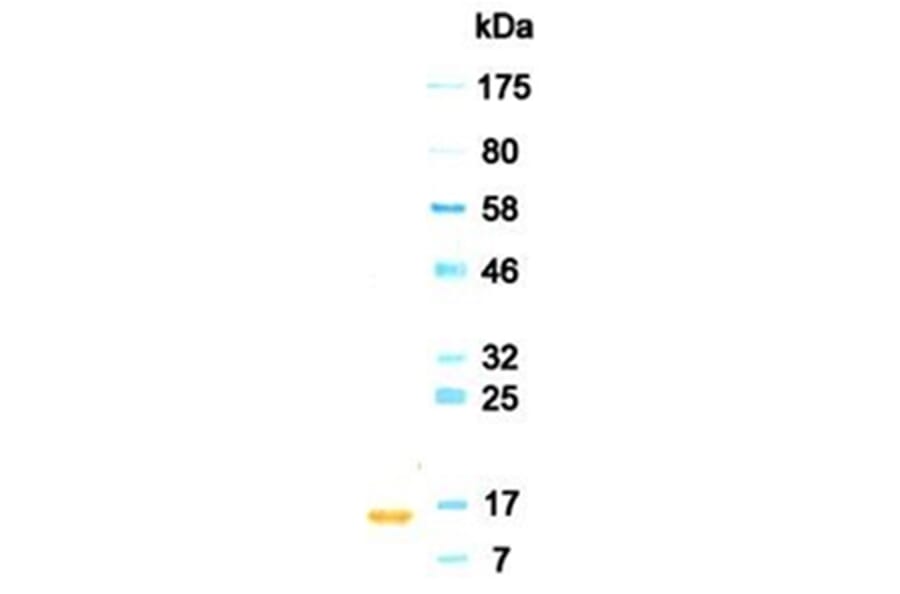 Western Blot - Anti-IFNA2 (IFNα2) Antibody (030102A07) - Antibodies.com