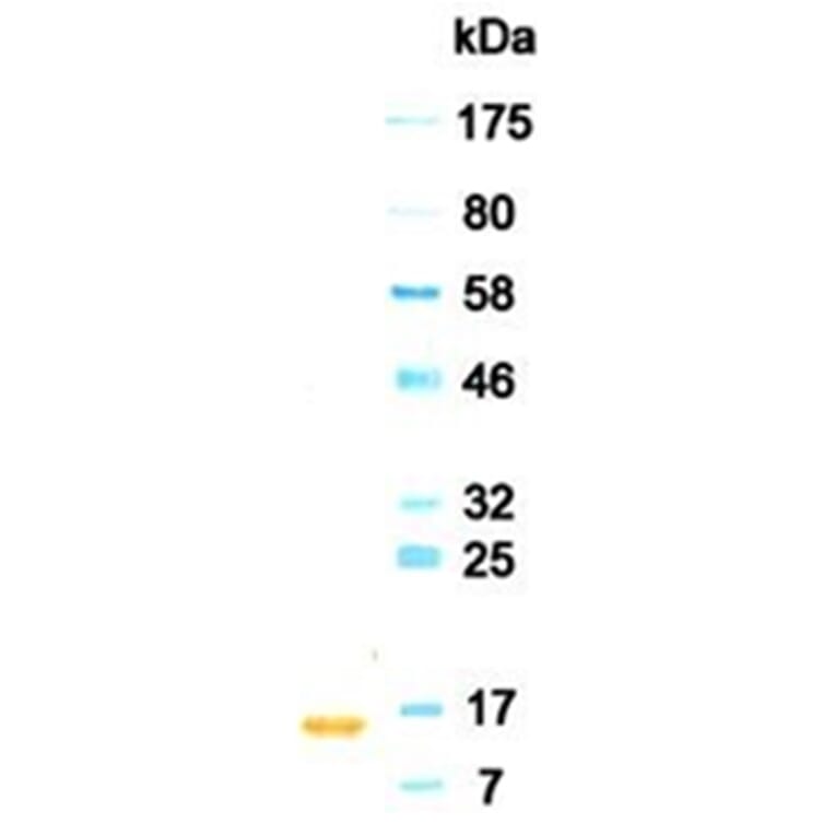 Western Blot - Anti-IFNA2 (IFNα2) Antibody (030102A07) - Antibodies.com