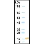 Western Blot - Anti-Endostatin Antibody (030105E03) - Antibodies.com