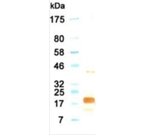 Western Blot - Anti-IL11 Antibody (030115G06) - Antibodies.com