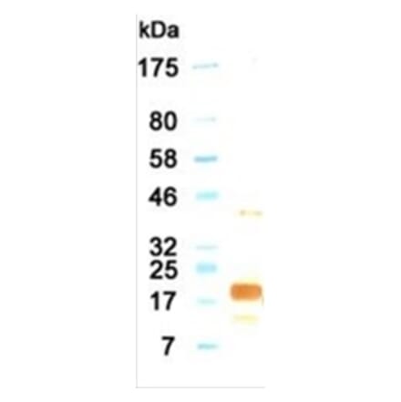 Western Blot - Anti-IL11 Antibody (030115G06) - Antibodies.com