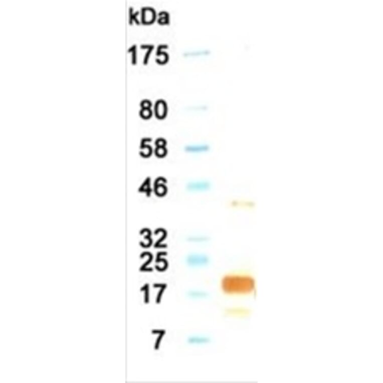 Western Blot - Anti-IL11 Antibody (030115G06) - Antibodies.com