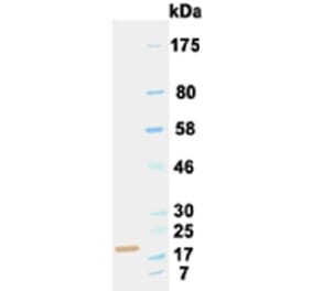 Western Blot - Anti-IL6 Antibody (030502B05) - Antibodies.com