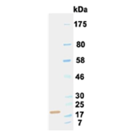 Western Blot - Anti-IL6 Antibody (030502B05) - Antibodies.com