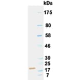 Western Blot - Anti-IL6 Antibody (030502B05) - Antibodies.com