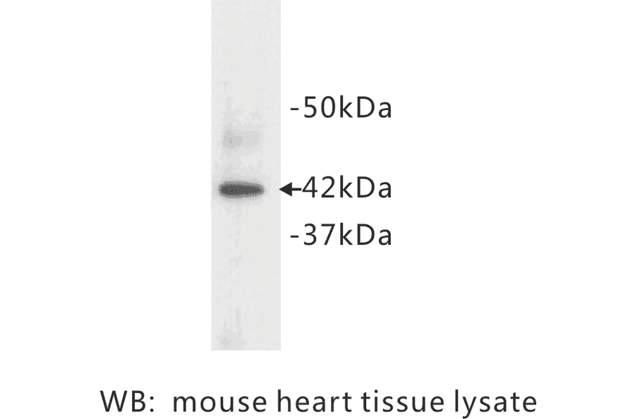 Western Blot - Anti-alpha Actin Antibody (BMA1002) - Antibodies.com