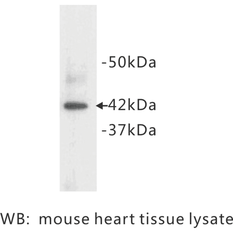 Western Blot - Anti-alpha Actin Antibody (BMA1002) - Antibodies.com