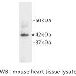 Western Blot - Anti-alpha Actin Antibody (BMA1002) - Antibodies.com