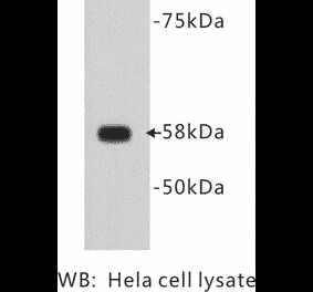 Western Blot - Anti-Alkaline Phosphatase Antibody (BMA1004) - Antibodies.com